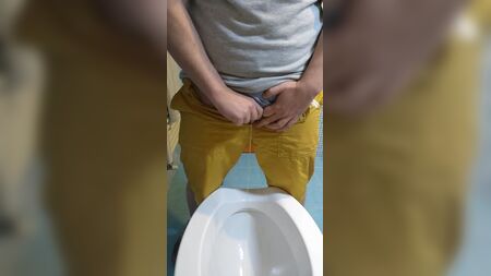 FTM metoidioplasti sonrası ayakta idrar yapma