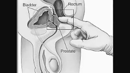 Prostatınızı Kendi Başınıza Nasıl Sütleyebilirsiniz